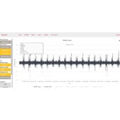 Dynapar OnSite Condition Monitoring System Vibration